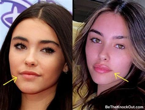 does madison beer have a boob job|Madison Beer shows “proof” she didn’t have plastic ...